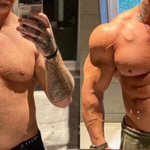 Mass gain cycle  – Injectables (Sustanon and Deca)